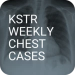 Logo of KSTR Weekly Chest Cases android Application 