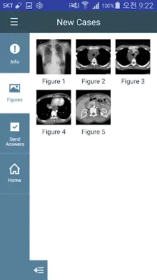 KSTR Weekly Chest Cases android App screenshot 0