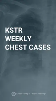 KSTR Weekly Chest Cases android App screenshot 3